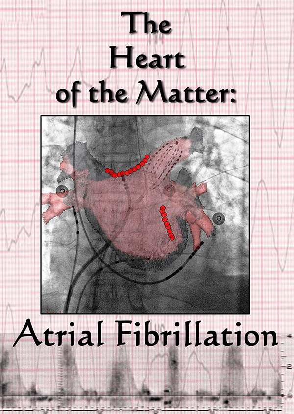 Heart_of_Matter_DVD_Jacket