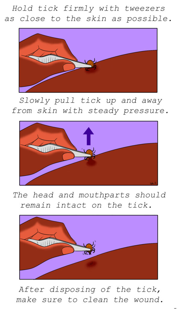 Tick Removal Directions 2